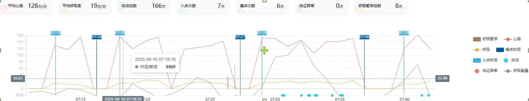 毫米波雷达局部呼吸暂停事件时间轴